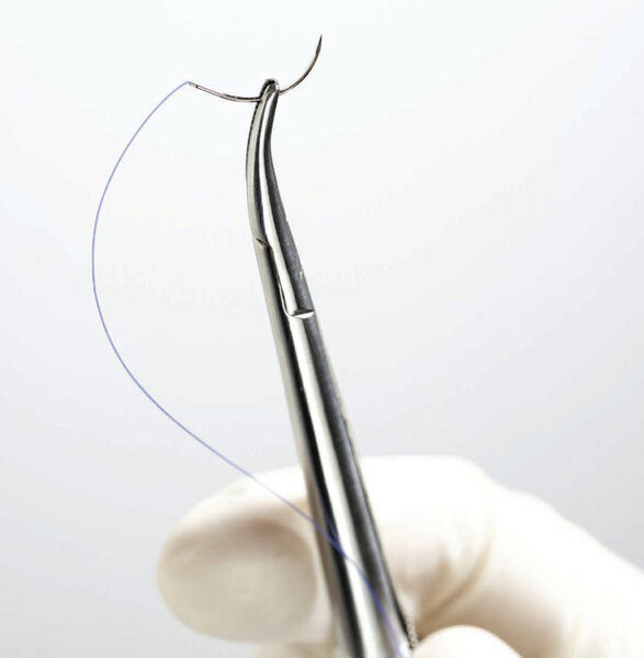 Pacing Wire